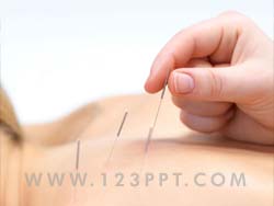 Acupuncture Photo Image