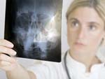 Doctor Examining X-rays presentation photo